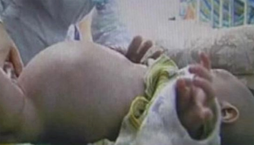 baby deliver 1